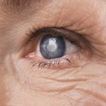 Diabetic Retinopathy Effects of Eyesight