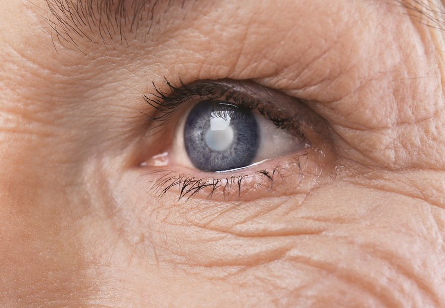 Diabetic Retinopathy Effects of Eyesight